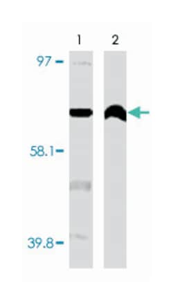 CYP4F11, Mouse, Clone: F21 P6 F5, Abnova 200&mu;g; Unlabeled:Antibodies,