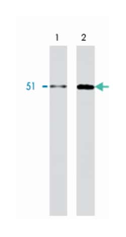 HNRNPK, Mouse, Clone: F45 P9 C7, Abnova 200&mu;g; Unlabeled:Antibodies,