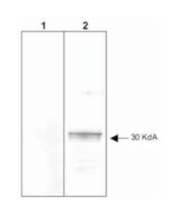 LEFTY2, Rabbit, Clone: 7C5G1H6H10, Abnova 100 &mu;g | Buy Online | Abnova | Fisher Scientific