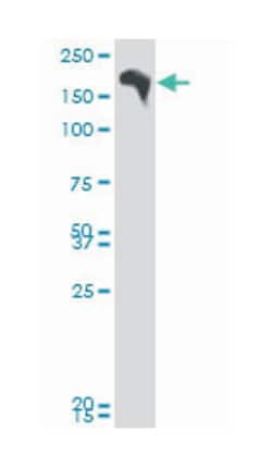 bromodomain adjacent to zinc finger domain, 1B, Mouse, Polyclonal Antibody,