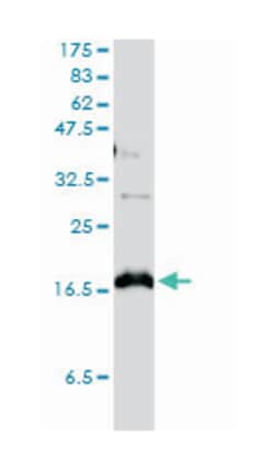 claudin 1, Mouse, Clone: 1C5-D9, Abnova 100&mu;g; Unlabeled:Antibodies,