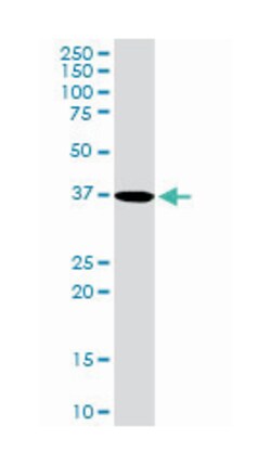 PDZ and LIM domain 1, Rabbit, Purified MaxPab Polyclonal Antibody, Abnova 100 &mu;g | Buy Online | Abnova Corporation | Fisher Scientific