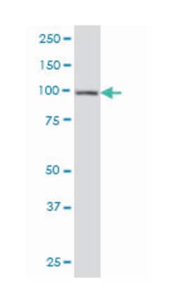 hepatocyte growth factor-regulated tyrosine kinase substrate, Mouse, Clone: