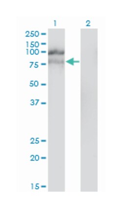 hepatocyte growth factor-regulated tyrosine kinase substrate, Mouse, Clone: