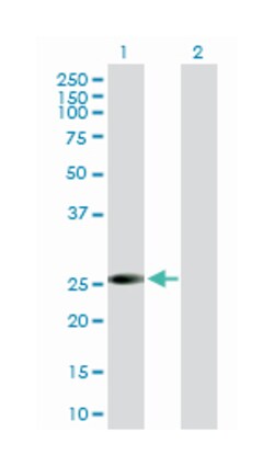 VAPB (B02P), Mouse anti-Human, Purified MaxPab Polyclonal Antibody, Abnova