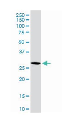 VAMP (vesicle-associated membrane protein)-associated protein B and C (D01P),