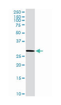 VAMP (vesicle-associated membrane protein)-associated protein B and C (D01P),