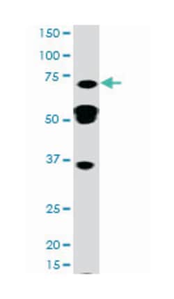 STAT3 (phospho Y705), Rabbit anti-Human, Polyclonal Antibody, Abnova 400&mu;L;