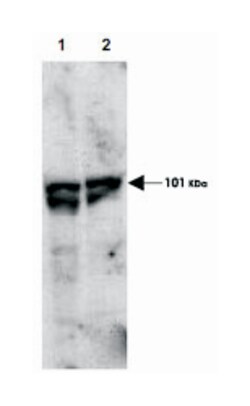 ECT2, Rabbit, Polyclonal Antibody, Abnova 100&mu;g; Unlabeled:Antibodies,