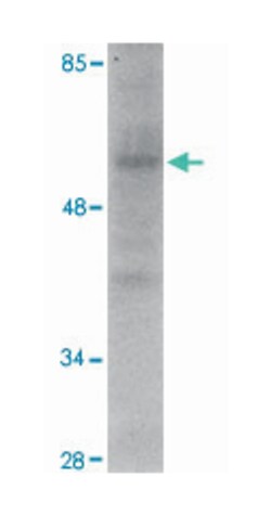 RNF168, Rabbit, Polyclonal Antibody, Abnova 100 &mu;g | Buy Online | Abnova | Fisher Scientific