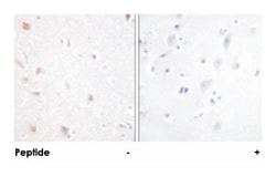 MKI67IP Rabbit anti-Human, Mouse, Polyclonal Antibody, Abnova 100&mu;g;