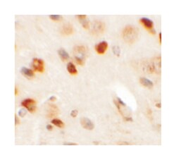 CMYA5, Rabbit, Polyclonal Antibody, Abnova 100&mu;g; Unlabeled:Antibodies,