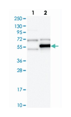 TRMT5, Rabbit, Polyclonal Antibody, Abnova 100 &mu;L | Buy Online | Abnova Corporation | Fisher Scientific