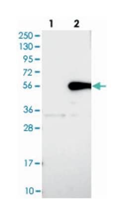 MTX1, Rabbit, Polyclonal Antibody, Abnova 100 &mu;L | Buy Online | Abnova Corporation | Fisher Scientific