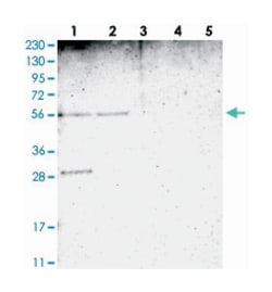 TMEM180, Rabbit, Polyclonal Antibody, Abnova 100 &mu;L | Buy Online | Abnova Corporation | Fisher Scientific