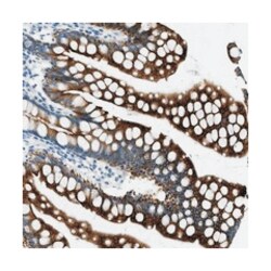 C16orf80, Rabbit, Polyclonal Antibody, Abnova 100 &mu;L | Buy Online | Abnova | Fisher Scientific