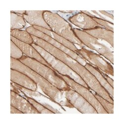 MURC Rabbit anti-Human, Polyclonal Antibody, Abnova 100 &mu;L | Buy Online | Abnova Corporation | Fisher Scientific