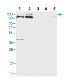 SNRNP200, Rabbit, Polyclonal Antibody, Abnova 100&mu;L; Unlabeled:Antibodies,