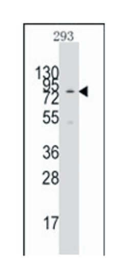 KAT2A (GCN5L2), Rabbit, Polyclonal Antibody, Abnova 400 &mu;L | Buy Online | Abnova Corporation | Fisher Scientific