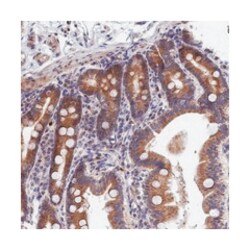 EPB41L4B, Rabbit, Polyclonal Antibody, Abnova 100 &mu;L | Buy Online | Abnova Corporation | Fisher Scientific