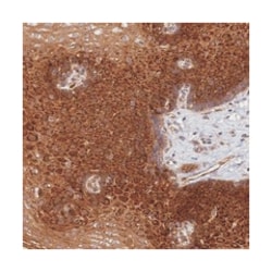 LUZP4, Rabbit, Polyclonal Antibody, Abnova 100&mu;L; Unlabeled:Antibodies,