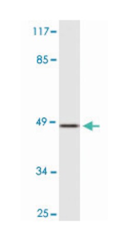 AGER Rabbit anti-Human, Polyclonal Antibody, Abnova 100 &mu;L | Buy Online | Abnova Corporation | Fisher Scientific