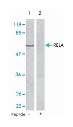 RELA Rabbit anti-Human, Mouse, Rat, Polyclonal Antibody, Abnova 100 &mu;g | Buy Online | Abnova Corporation | Fisher Scientific