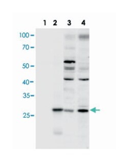 Znrf1, Goat, Polyclonal Antibody, Abnova 100&mu;g; Unlabeled:Antibodies,