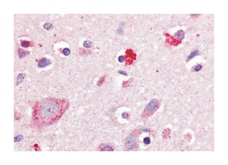 RORB Rabbit anti-Bovine, Chicken, Dog, Hamster, Horse, Human, Monkey, Mouse, Rabbit, Rat, Sheep, Polyclonal Antibody, Abnova 50 &mu;g | Buy Online | Abnova | Fisher Scientific