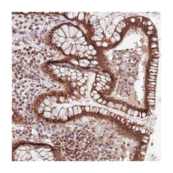 RCOR2, Rabbit, Polyclonal Antibody, Abnova 100&mu;L; Unlabeled:Antibodies,