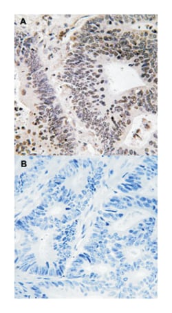 WWOX (phospho Y33), Rabbit anti-Human, Mouse, Polyclonal Antibody, Abnova 100 &mu;L | Buy Online | Abnova Corporation | Fisher Scientific