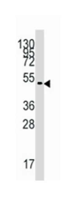 PDK4 Rabbit anti-Human, Polyclonal Antibody, Abnova 400 &mu;L | Buy Online | Abnova Corporation | Fisher Scientific