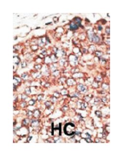 MMP17 Rabbit anti-Human, Polyclonal Antibody, Abnova 400&mu;L; Unlabeled:Antibodies,