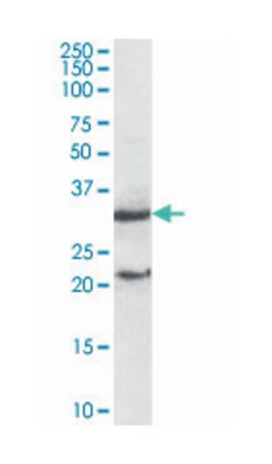 SOCS1, Goat, Polyclonal Antibody, Abnova 100&mu;g; Unlabeled:Antibodies