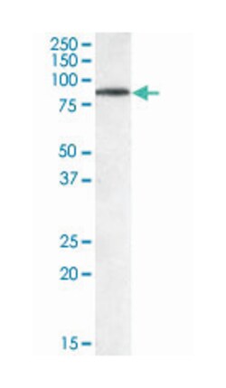 TRIM3, Goat, Polyclonal Antibody, Abnova 100 &mu;g | Buy Online | Abnova Corporation | Fisher Scientific