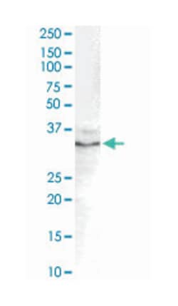 GDF15, Goat, Polyclonal Antibody, Abnova 100 &mu;g | Buy Online | Abnova Corporation | Fisher Scientific