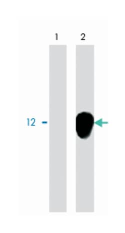 DAP12, Rabbit, Polyclonal Antibody, Abnova 100 &mu;g | Buy Online | Abnova Corporation | Fisher Scientific