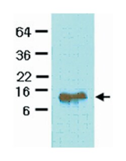 FABP4, Mouse, Clone: 3F4, Abnova 100&mu;L; Unlabeled:Antibodies, Monoclonal