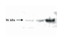 PMS2, Mouse, Clone: 349.29.5.2, Abnova 100 &mu;g | Buy Online | Abnova | Fisher Scientific