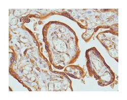 EGFR, Rabbit, Clone: SP9, Abnova 100 &mu;L | Buy Online | Abnova Corporation | Fisher Scientific