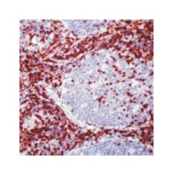 CD5, Rabbit, Clone: SP19, Abnova 100 &mu;L | Buy Online | Abnova Corporation | Fisher Scientific