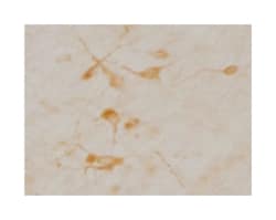 SLC5A7, Mouse, Clone: 62-2E8, Abnova 100&mu;L; Unlabeled:Antibodies, Monoclonal