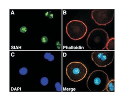 SIAH2, Mouse, Clone: 24E6H3, Abnova 500&mu;L; Unlabeled:Anticuerpos