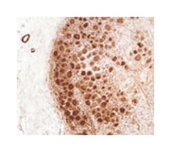 NF1, Mouse, Clone: McNFn27, Abnova 200&mu;L; Unlabeled:Antibodies, Monoclonal