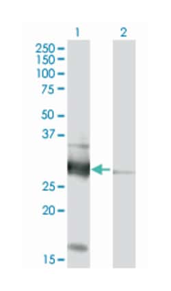 VAPB (B01P), Mouse anti-Human, Purified MaxPab Polyclonal Antibody, Abnova