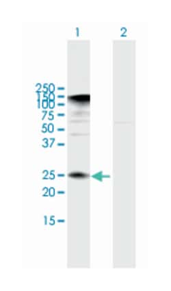 IL32, Mouse, Polyclonal Antibody, Abnova 50&mu;L; Unlabeled:Antibodies,