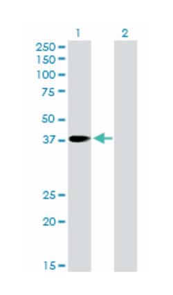 paraneoplastic antigen MA1, Rabbit, Purified MaxPab Polyclonal Antibody,