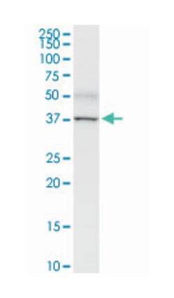 paraneoplastic antigen MA1, Rabbit, Purified MaxPab Polyclonal Antibody,