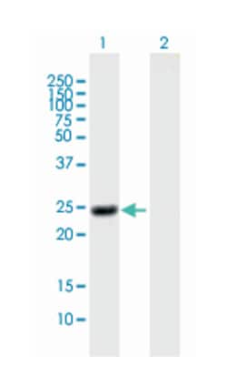 NOG, Mouse, Purified MaxPab Polyclonal Antibody, Abnova 50&mu;g; Unlabeled:Antibodies,