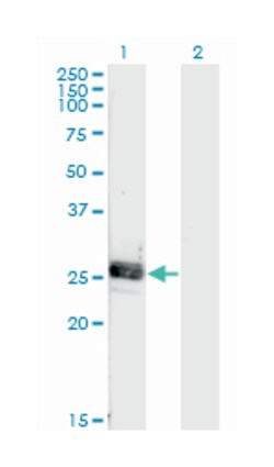 NOG, Mouse, Clone: 4A1, Abnova 100&mu;g; Unlabeled:Antibodies, Monoclonal